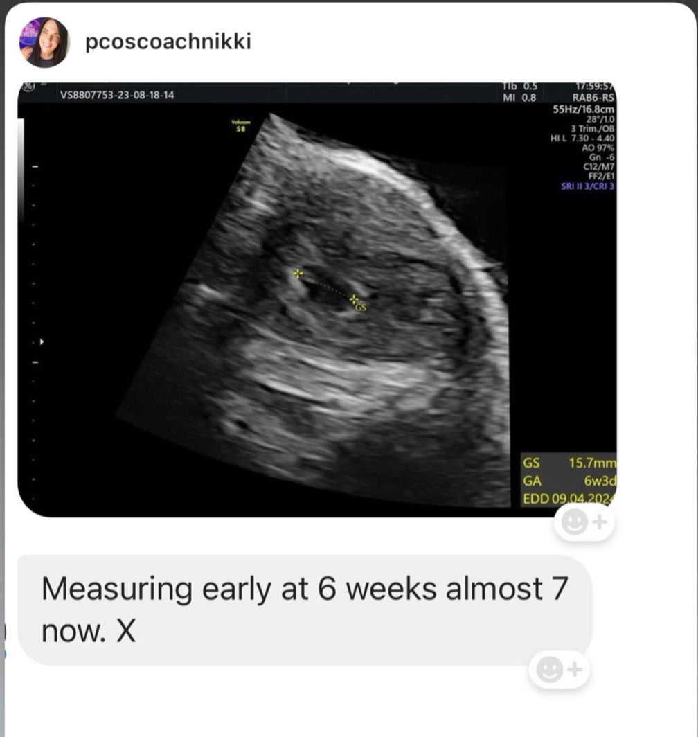 BLACK FRIDAY - The PCOS Freedom Subscription
Includes The Magic Drink + Hormone Reset Tea + VIP access to exclusive PCOS education & community